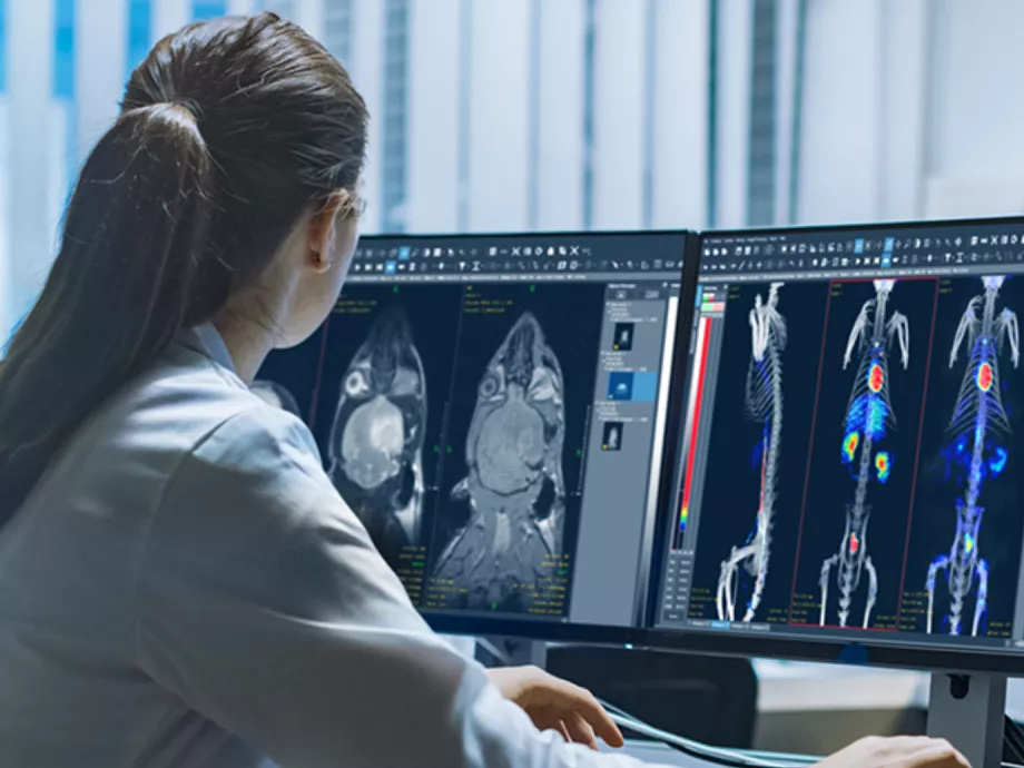 Dedikált agyvizsgáló PET/CT berendezést fejlesztettek  neurológiai betegségek klinikai kutatására és diagnosztikájára