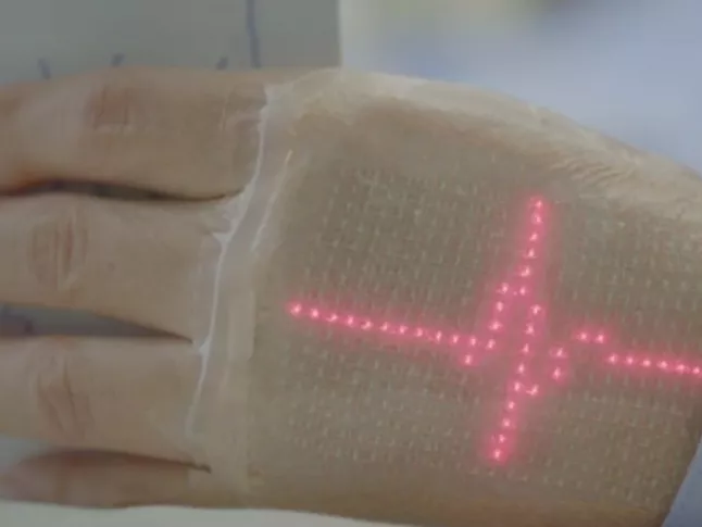 Az e-bőr a beteg testén jelzi ki az élettani adatait