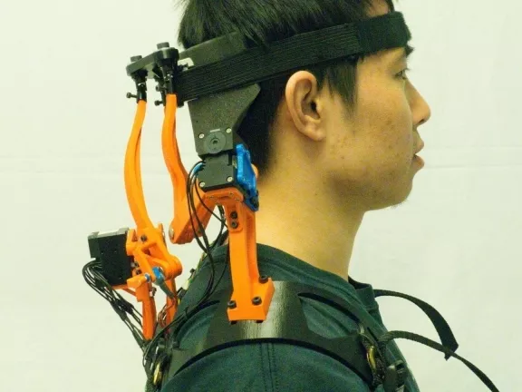 Robot-nyakmerevítő ALS-os betegek számára