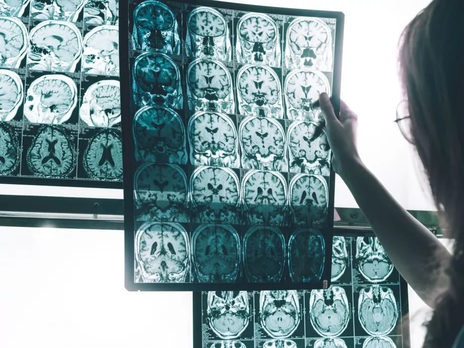 A PREDICTOM egy MI-alapú Alzheimer szűrési platformot fejleszt